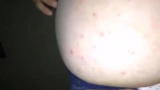 PLAVE GACICE, pusenje, velika bulja,vlazna picka 2021